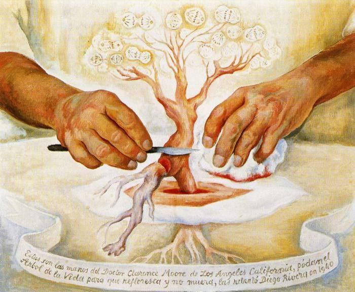 Diego Rivera. The Hands of Dr Moore. / Los
 manos del Dr. Moore.